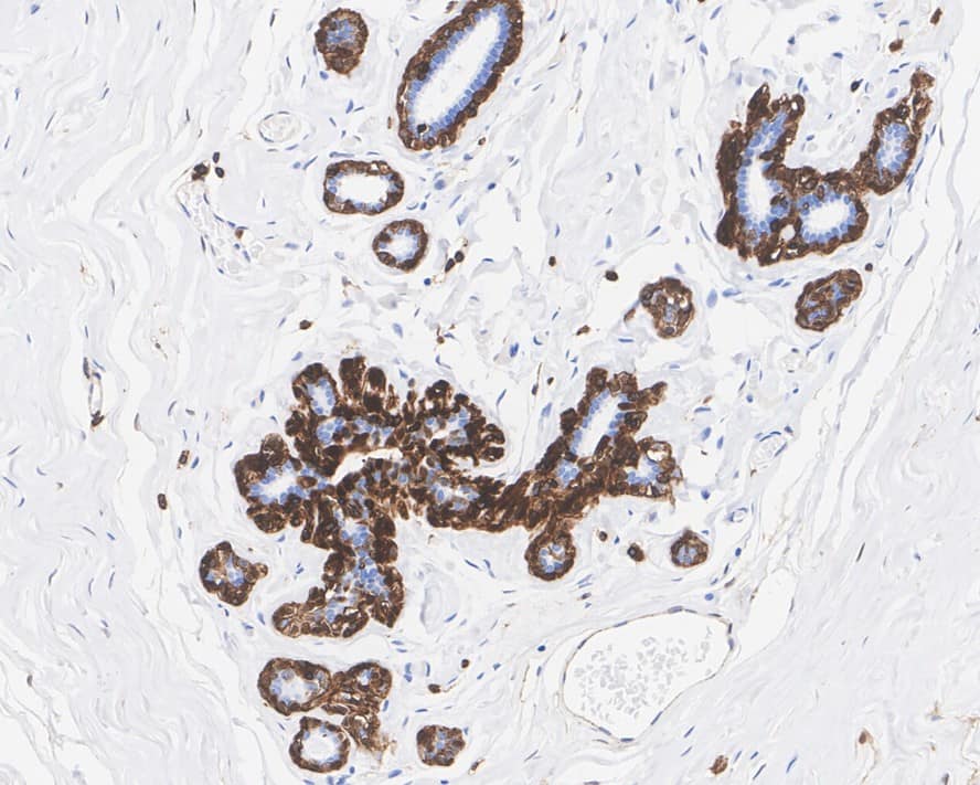 Annexin A1 Antibody (PSH04-13)