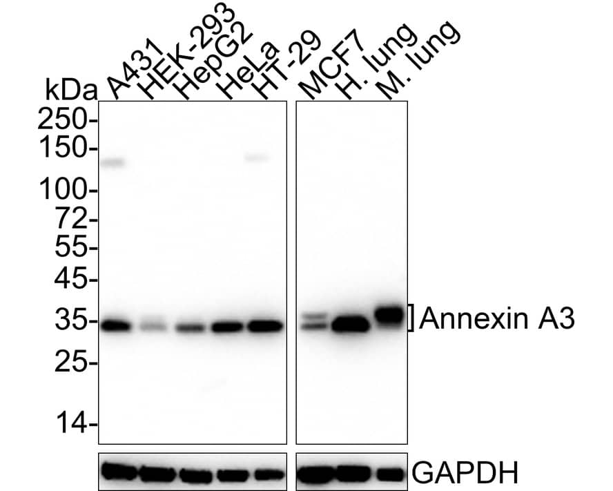 Annexin A3 Antibody (A1F7-R)