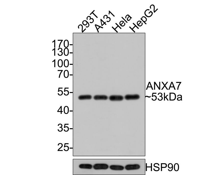 Annexin A7 Antibody (JE65-60)