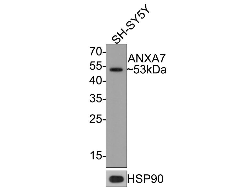 Annexin A7 Antibody (JE65-36)