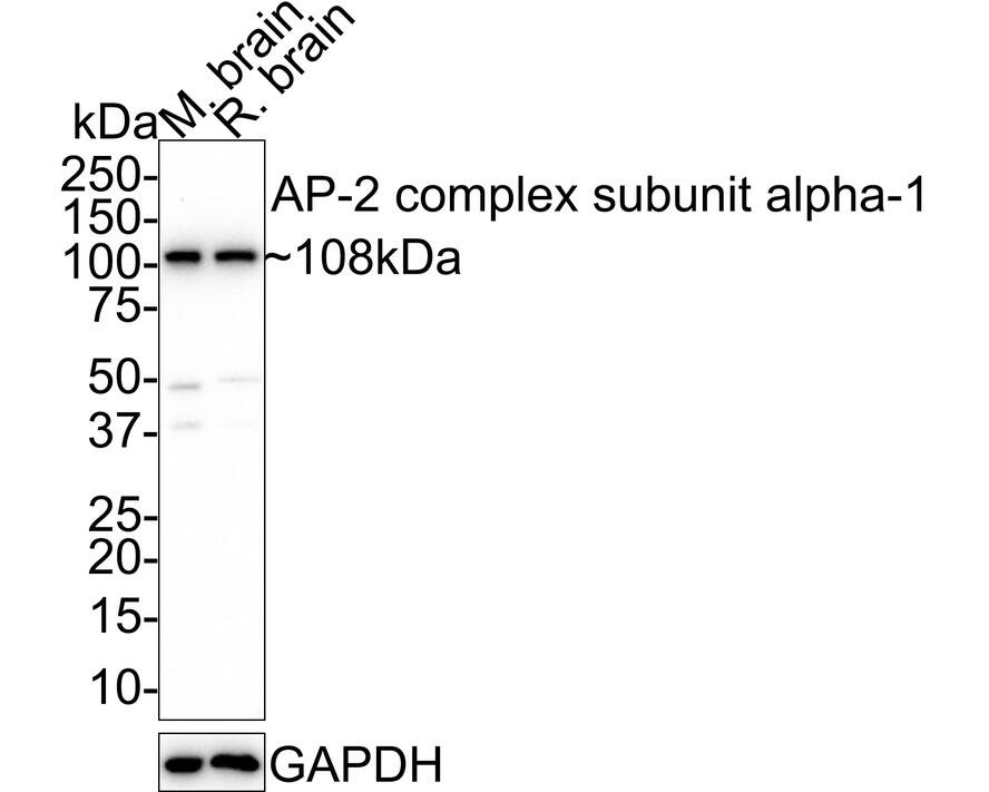 alpha Adaptin Antibody (JE40-38) Western Blot: alpha Adaptin Antibody (JE40-38) [NBP3-32040]