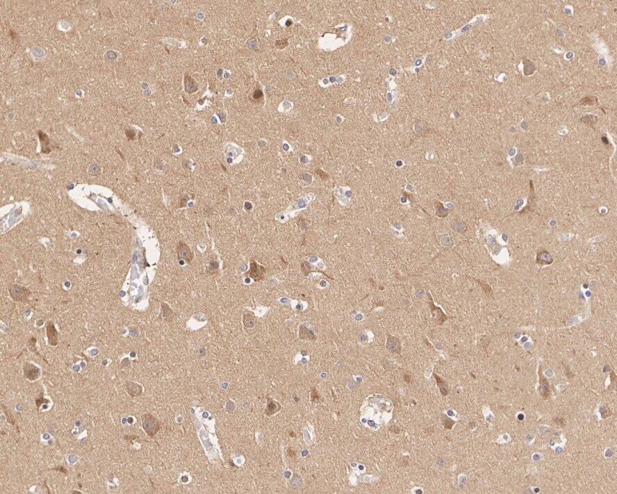 alpha Adaptin Antibody (JE40-38)