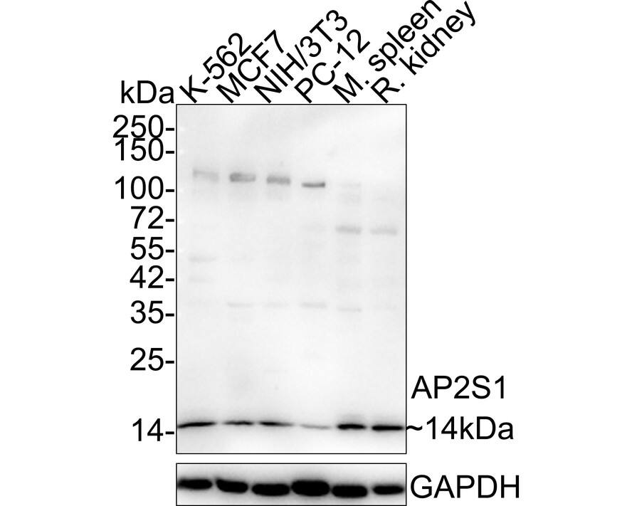 AP2S1 Antibody (JE47-37)