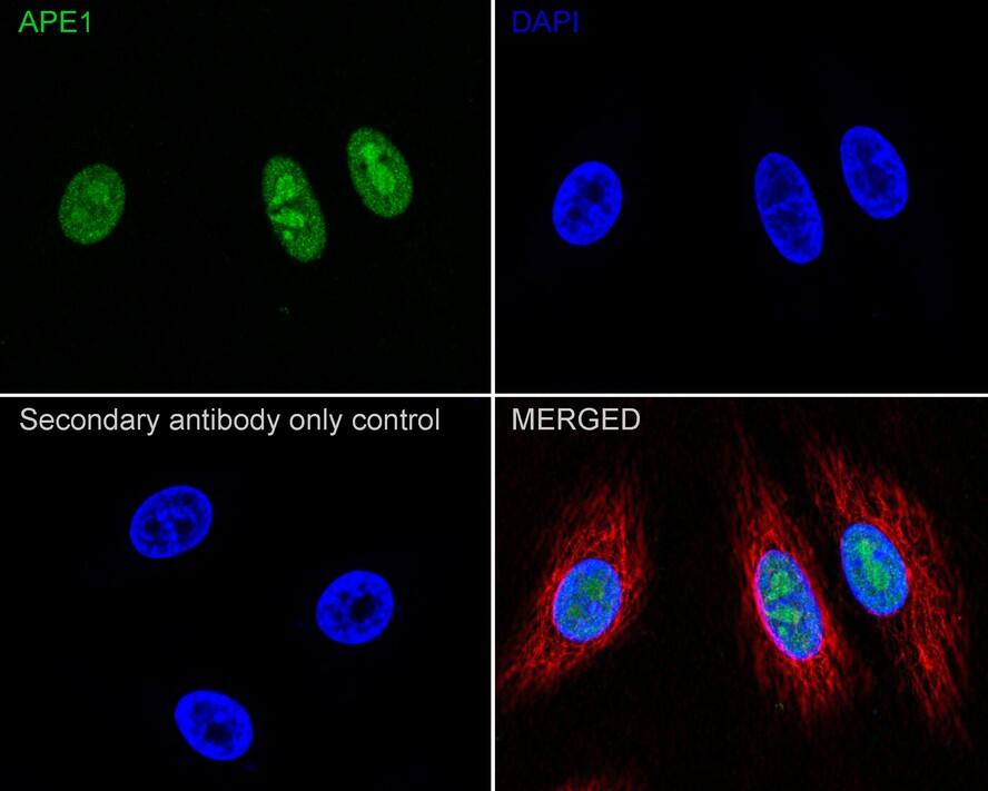 APE Antibody (12H2-R)