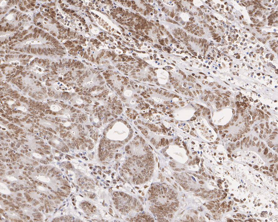 APE Antibody (12H2-R)