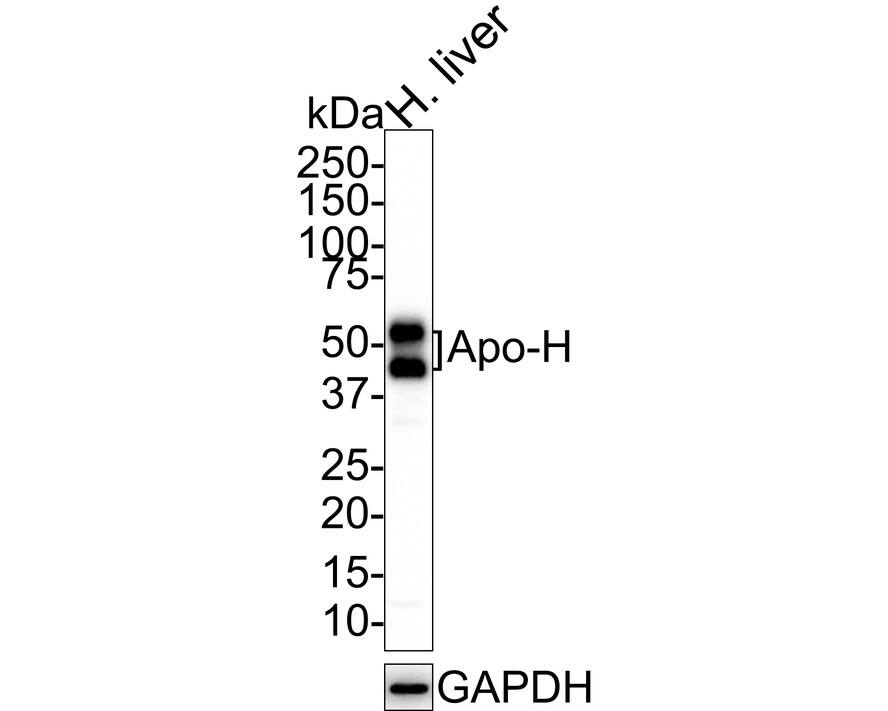 Apolipoprotein H/ApoH Antibody (JE37-02)