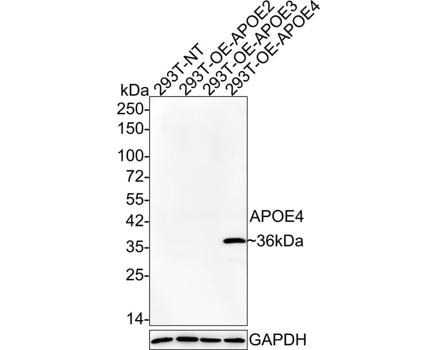 Apolipoprotein E/ApoE Antibody (PSH02-85) Western Blot: Apolipoprotein E/ApoE Antibody (PSH02-85) [NBP3-32045]