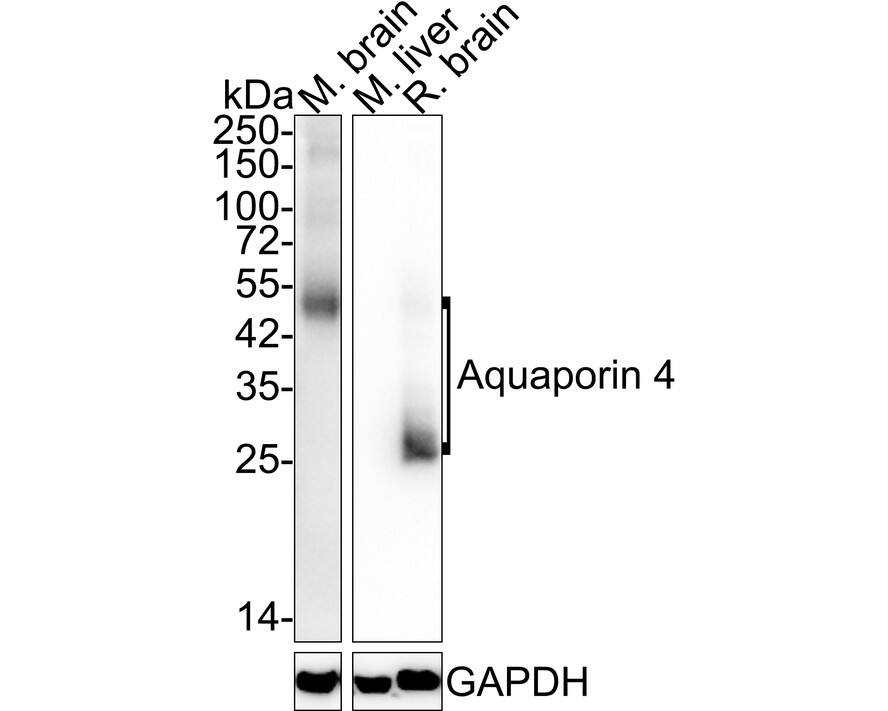 Aquaporin-4 Antibody (JE59-76)