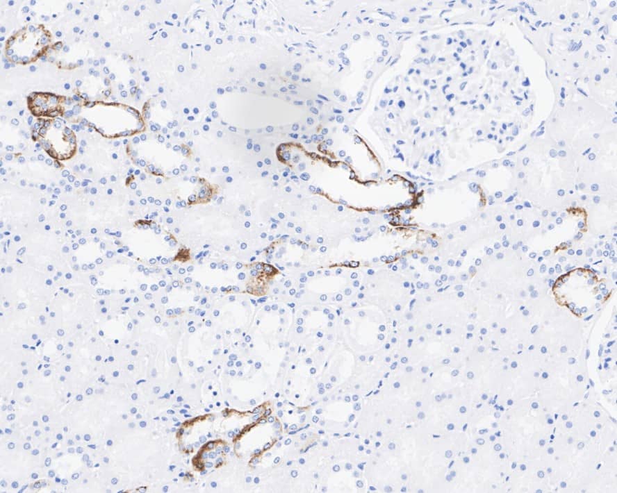 Aquaporin-4 Antibody (JE59-76)