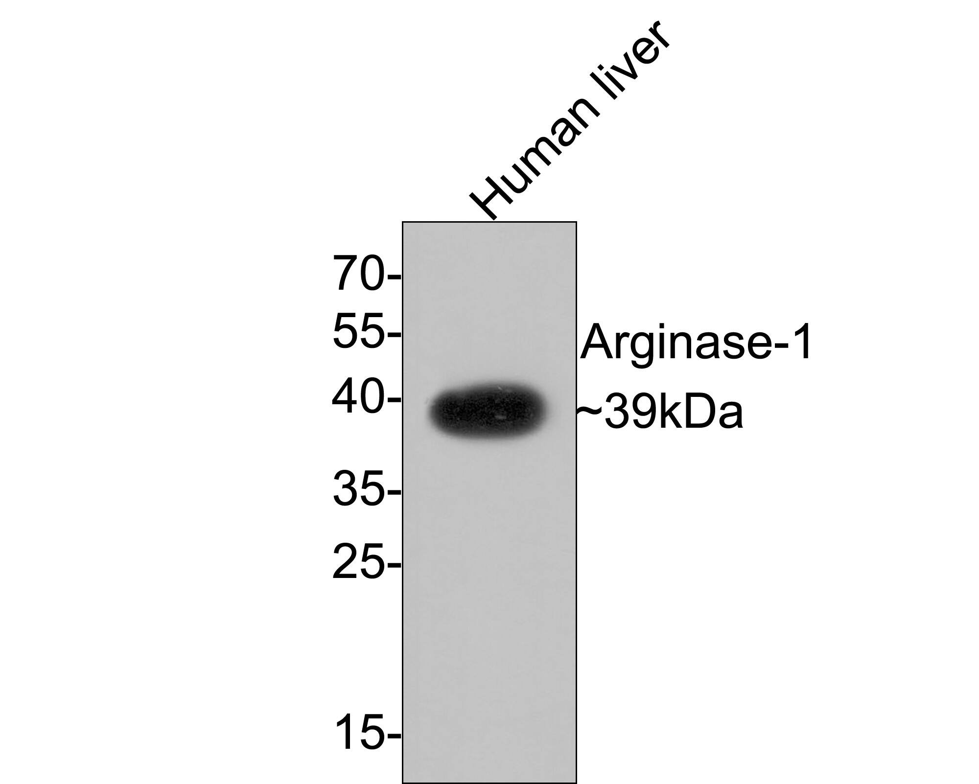 Arginase 1/ARG1/liver Arginase Antibody (PD00-05)