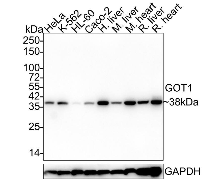 Aspartate Aminotransferase Antibody (A2D6-R) Western Blot: Aspartate Aminotransferase Antibody (A2D6-R) [NBP3-32050]