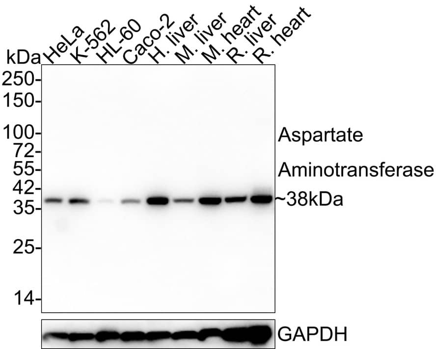 Aspartate Aminotransferase Antibody (A2D6-R)