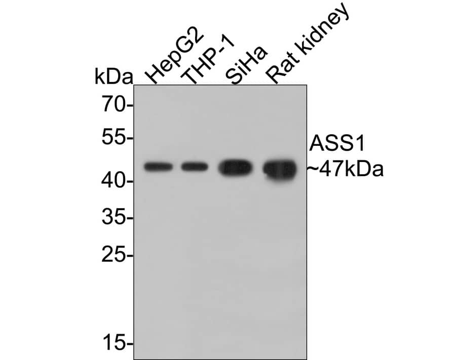 Argininosuccinate Synthase Antibody (11F1-RA)