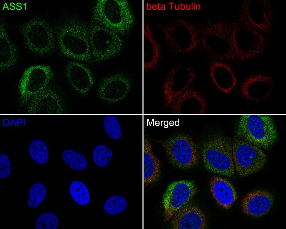Argininosuccinate Synthase Antibody (11F1-RA)