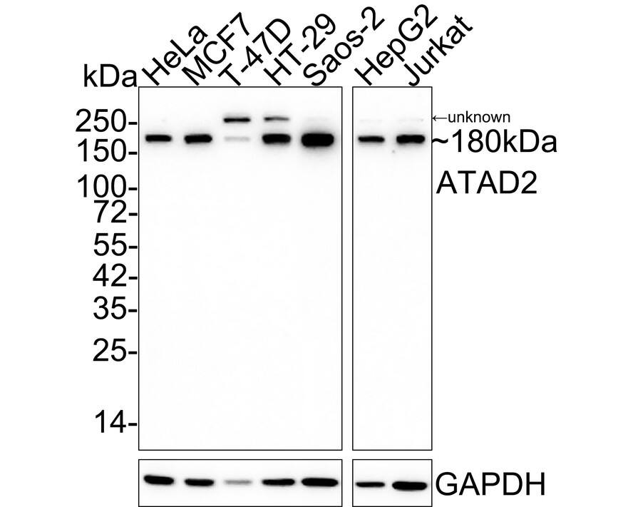 ATAD2 Antibody (JE34-52)