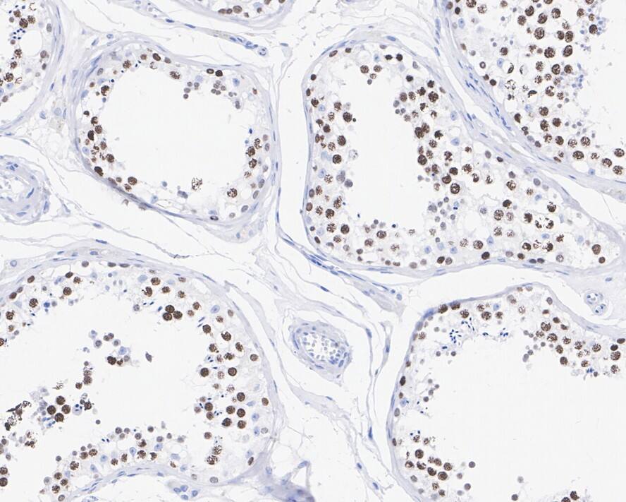 ATAD2 Antibody (JE34-52)