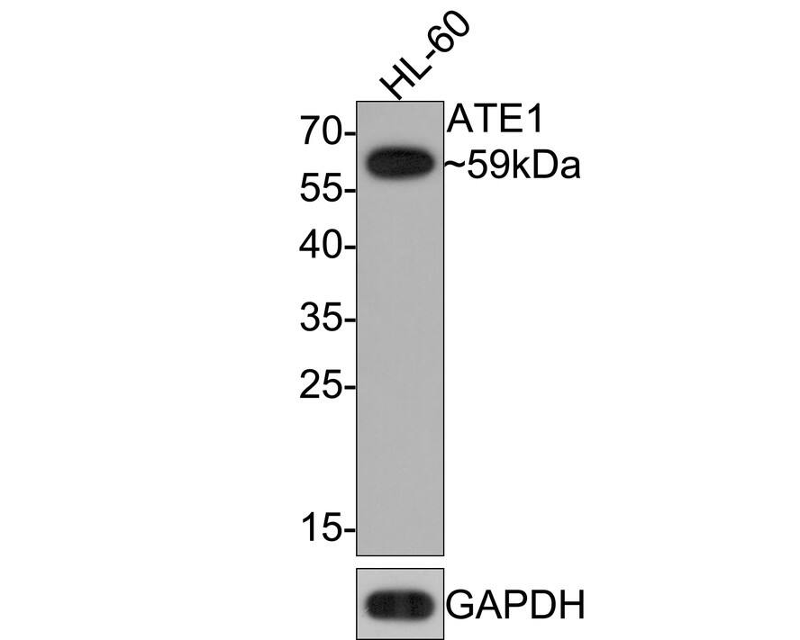 ATE1 Antibody (JE65-47)