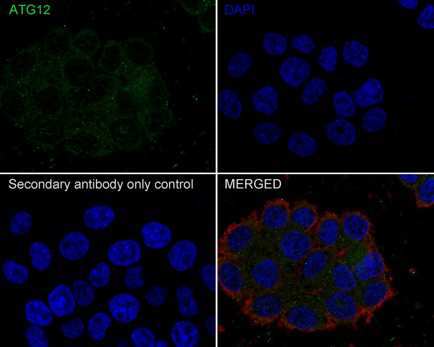 ATG12 Antibody (JE30-61)