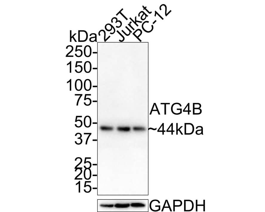 ATG4B Antibody (JE59-97)