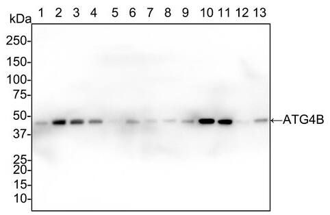 ATG4B Antibody (PSH02-53)