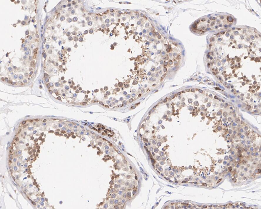 ATG4C Antibody (JE59-99)