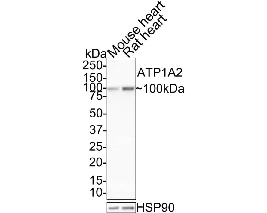 Sodium Potassium ATPase Alpha 2 Antibody (JE34-00)