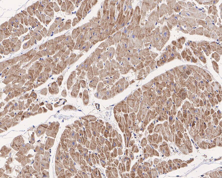Sodium Potassium ATPase Alpha 2 Antibody (JE34-00)