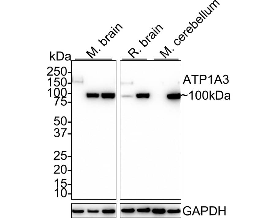 Sodium Potassium ATPase Alpha 3 Antibody (JE35-24)