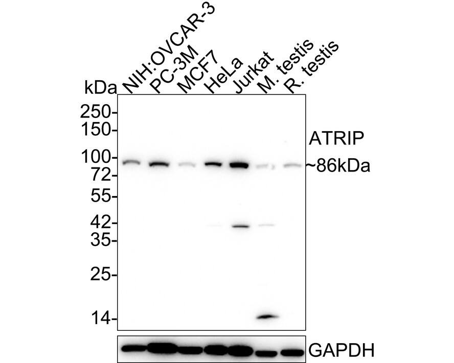 ATRIP Antibody (JE54-71)