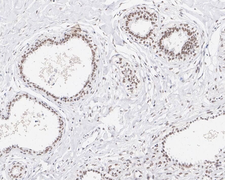 BAF180/PB1 Antibody (PSH02-34)