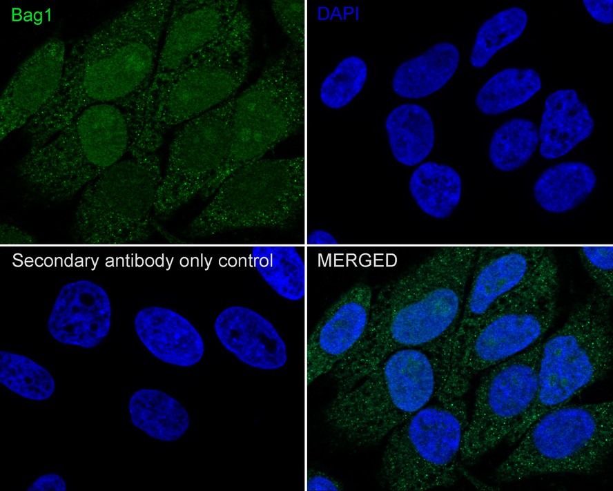 Bag-1 Antibody (JE63-22)