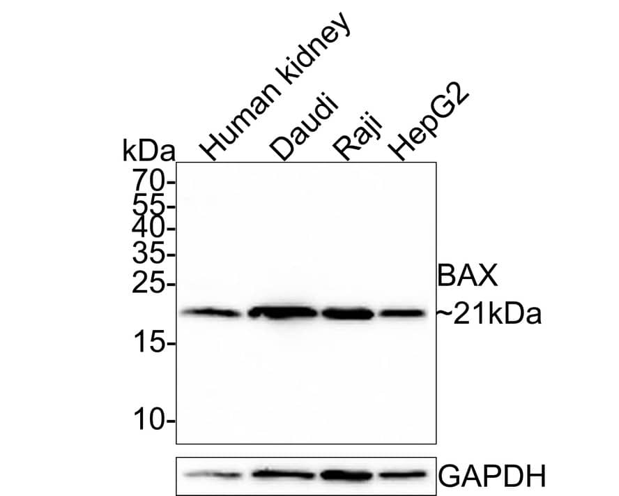 Bax Antibody (PSH0-20)