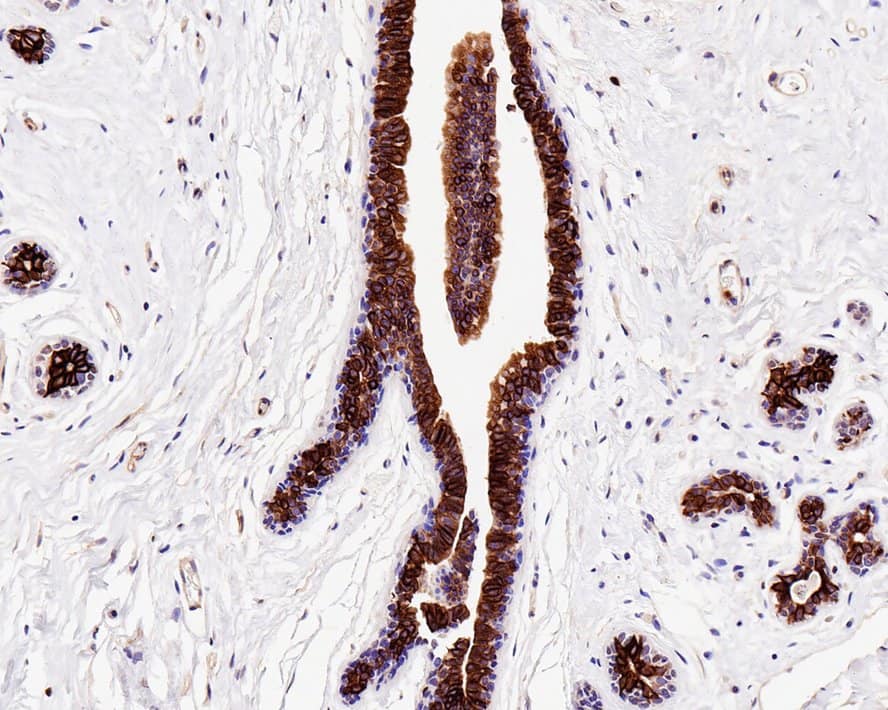 Bax Antibody (PD01-44)