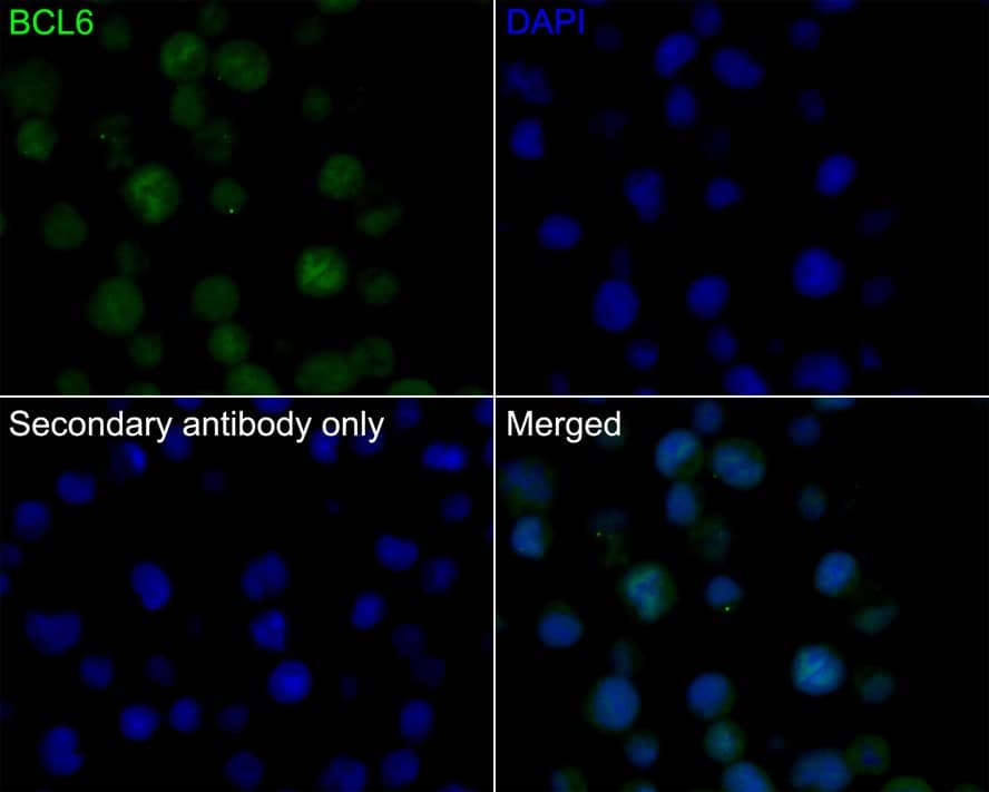 Bcl-6 Antibody (A6C7-R)