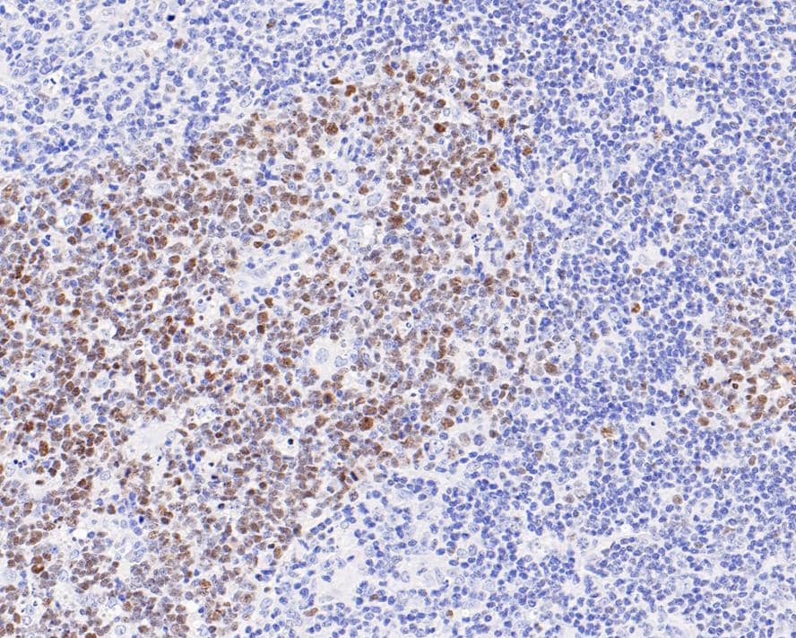 Bcl-6 Antibody (A6C8-R)