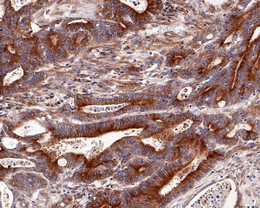 Beclin 1 Antibody (JE59-31)