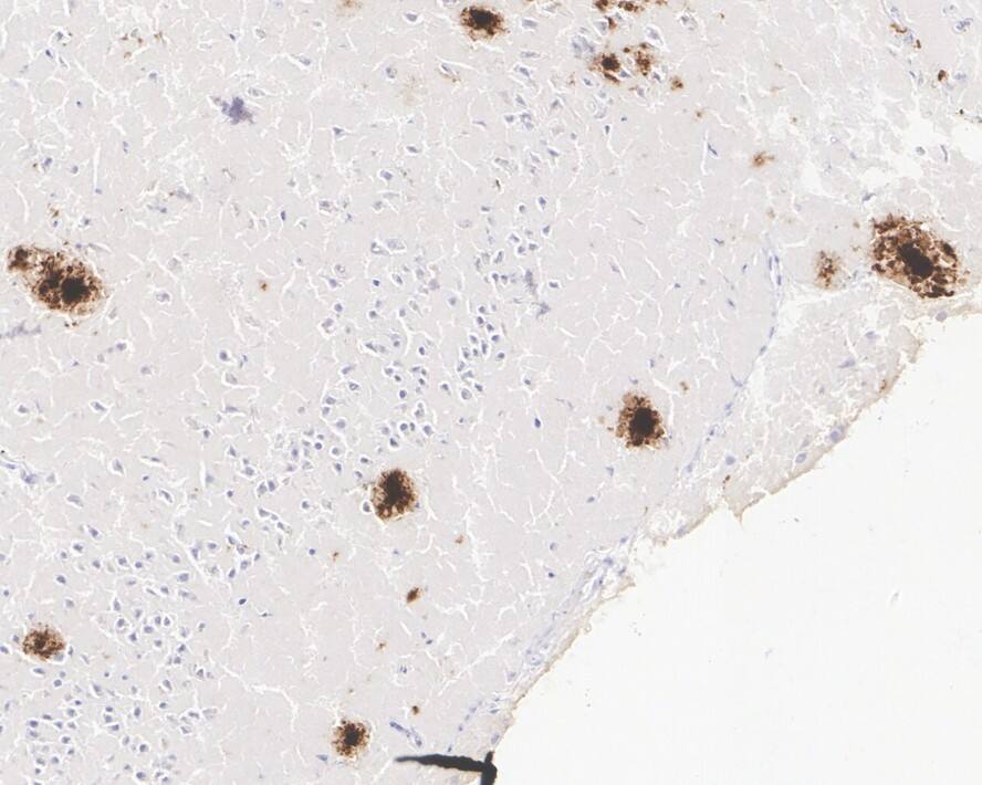 Abeta 42 Antibody (PSH02-83)