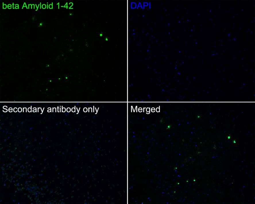 Abeta 42 Antibody (PSH02-83)