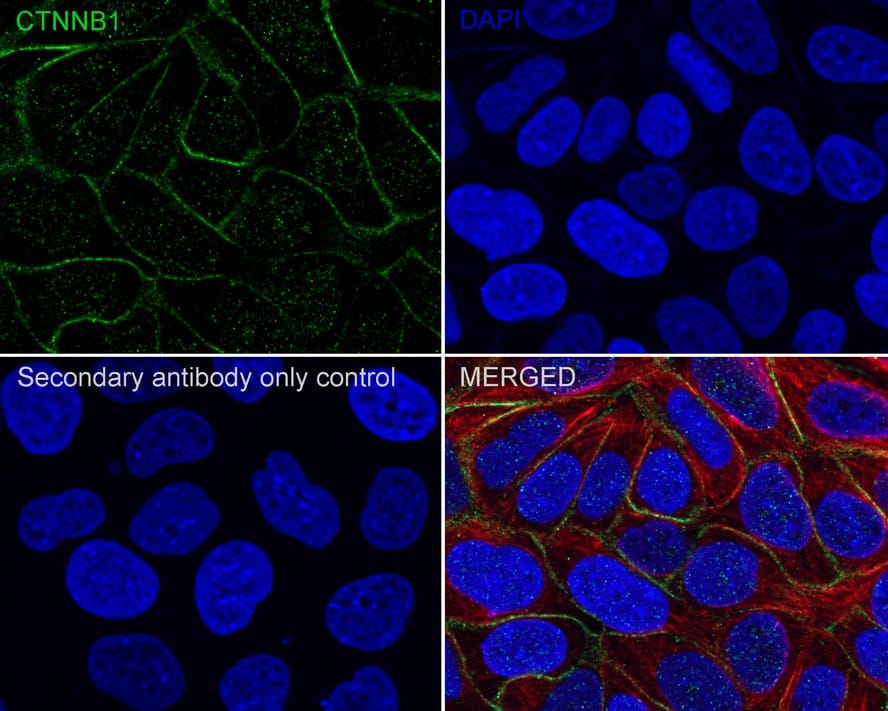 beta-Catenin Antibody (A6-F8-R)