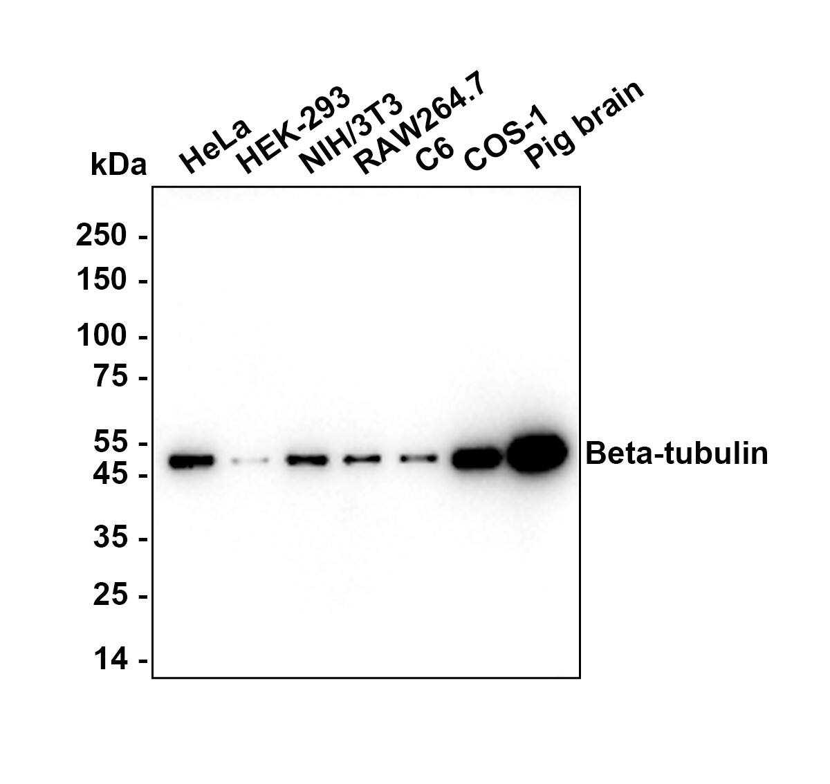 beta Tubulin Antibody (1-B11-R) Western Blot: beta Tubulin Antibody (1-B11-R) [NBP3-32080]