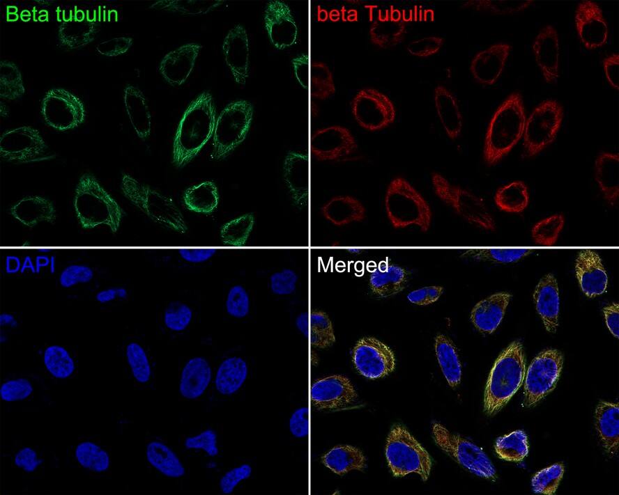 beta Tubulin Antibody (1-B11-R)