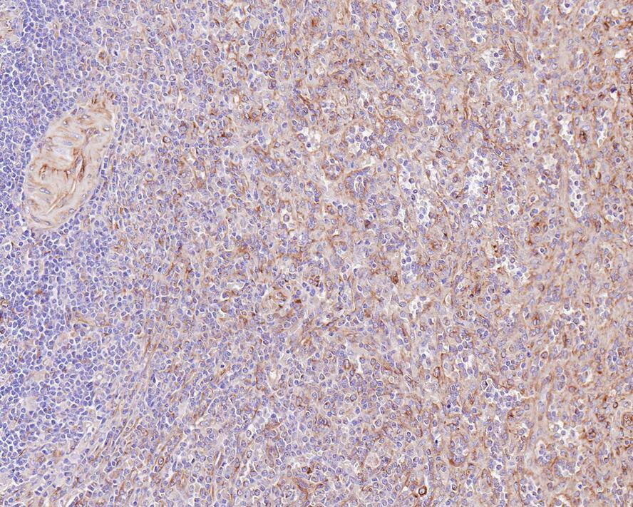 beta Tubulin Antibody (1-B11-R)