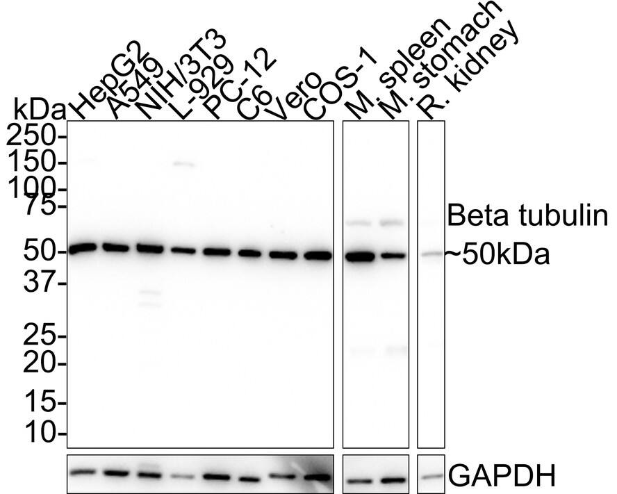 beta Tubulin Antibody (A1-A4-R) Western Blot: beta Tubulin Antibody (A1-A4-R) [NBP3-32081]