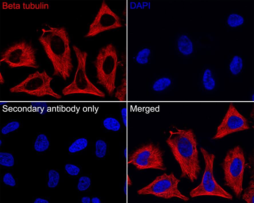 beta Tubulin Antibody (A1-A4-R)