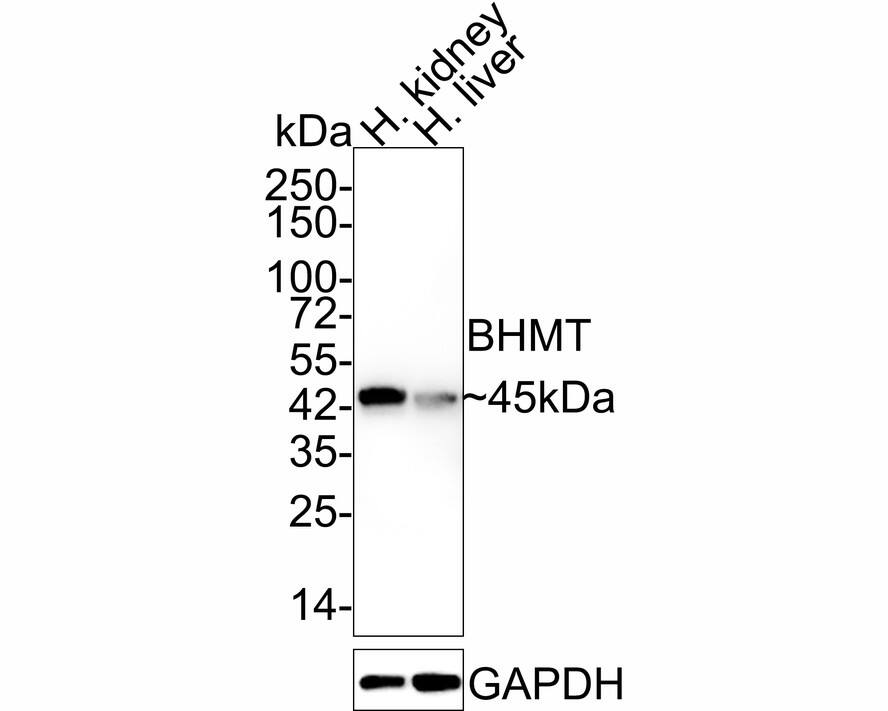 BHMT Antibody (9E1-R)