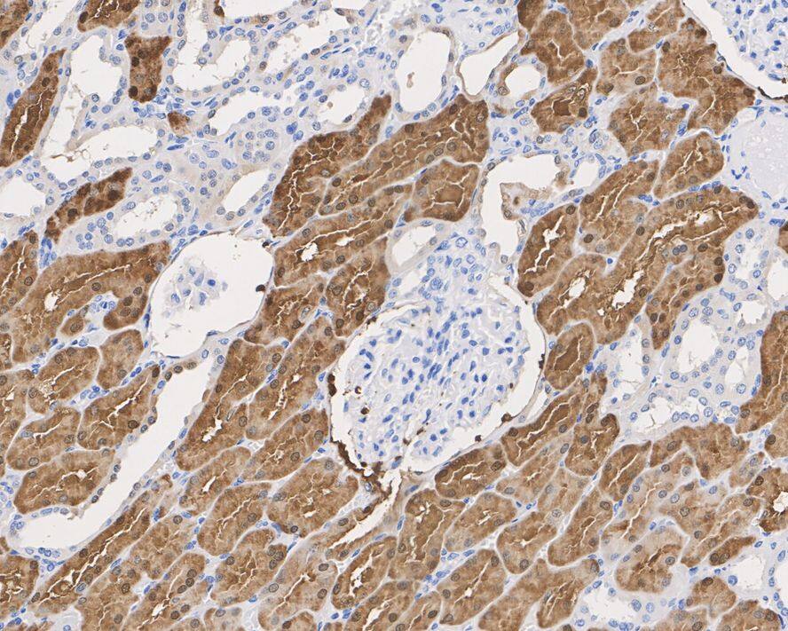 BHMT Antibody (9E1-R)