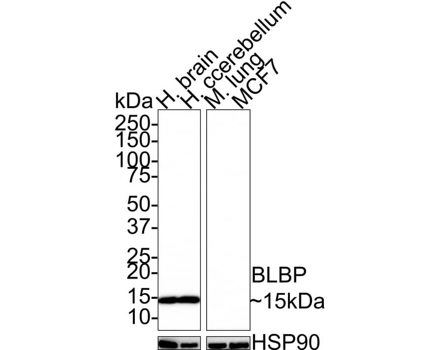 FABP7/B-FABP Antibody (PSH0-88)