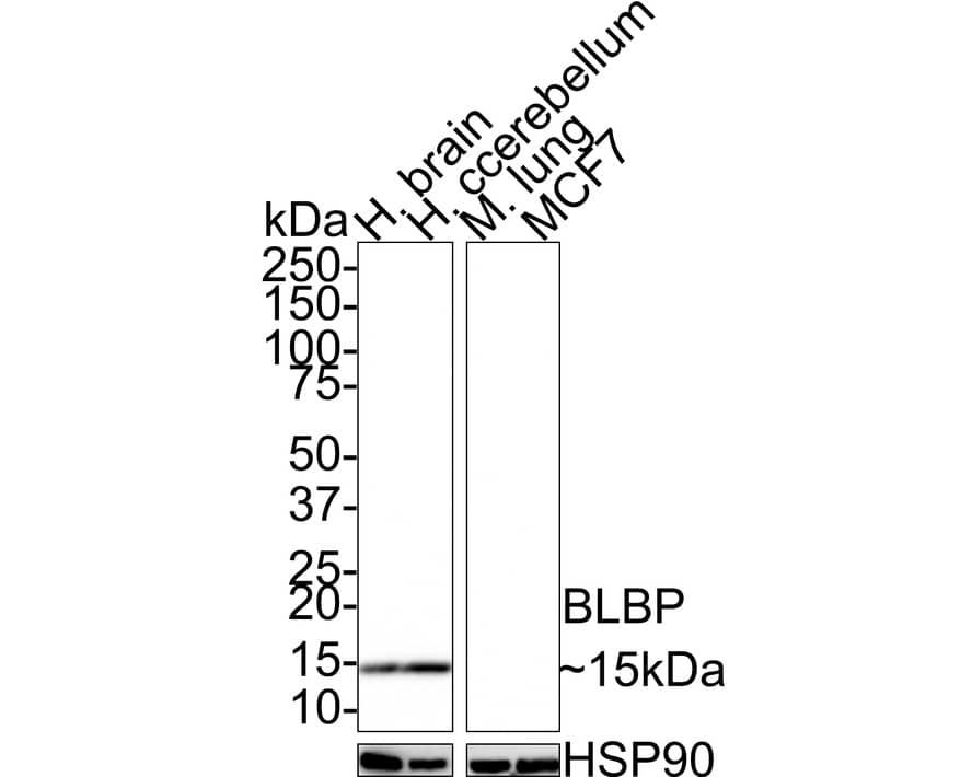 FABP7/B-FABP Antibody (PSH0-89)