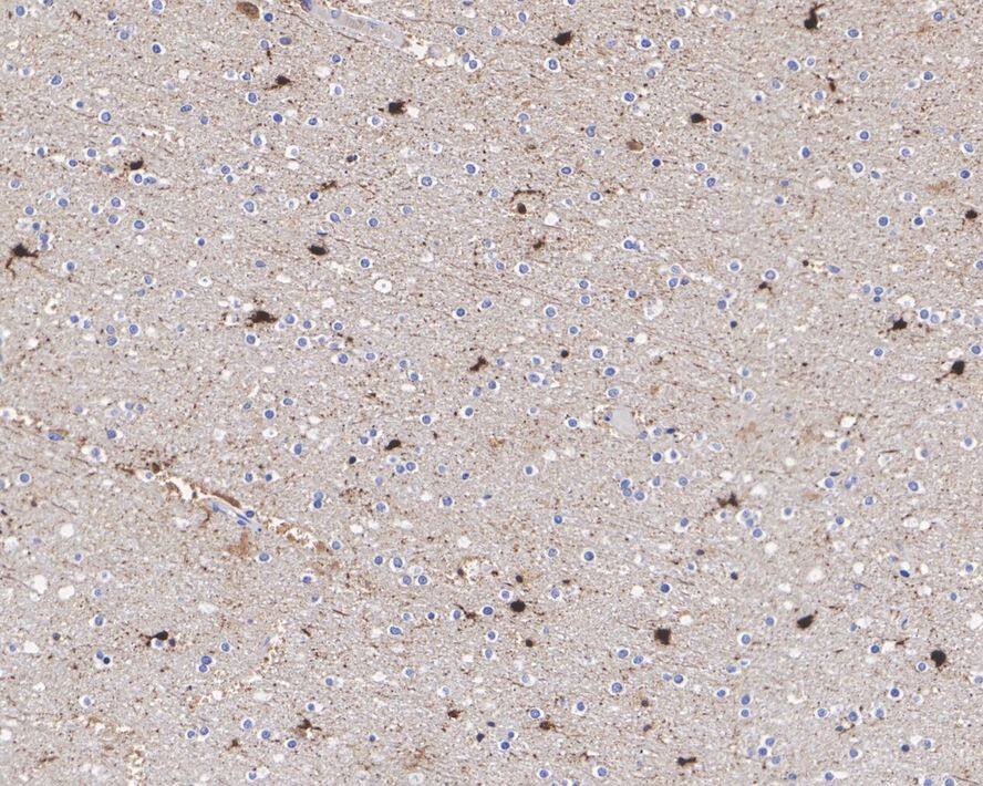 FABP7/B-FABP Antibody (PSH0-89)