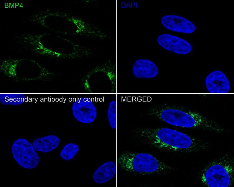 BMP-4 Antibody (JE42-44)